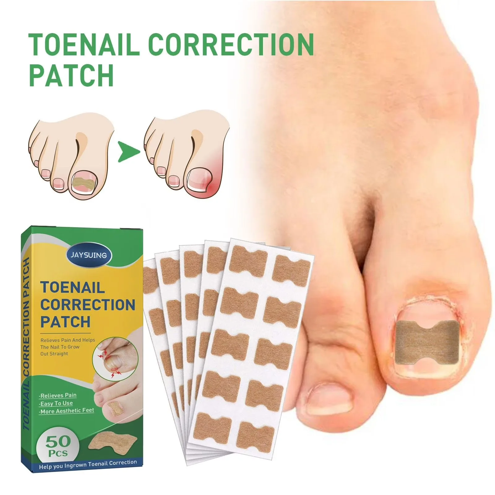 NailFix™ – Correcteur d’Ongle Incarné
