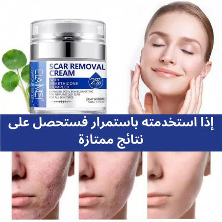 مل كريم لإزالة الندوب ر