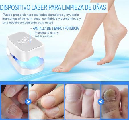 LASER UÑAS DEL PIE ANTI HONGOS