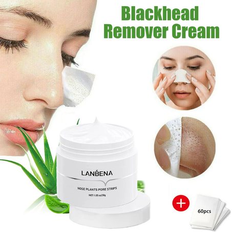 كريم lanbena لإزالة الرؤوس السوداء