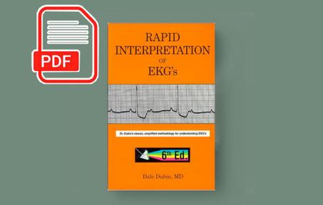 Rapid Interpretation of EKGs