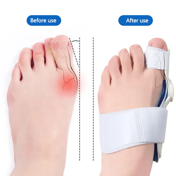 Correcteur pieds