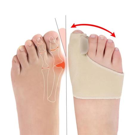 Correcteur Hallux Valgus – Attelle de Redressement du Gros Orteil | Soulage les Douleurs & Corrige les Déformations