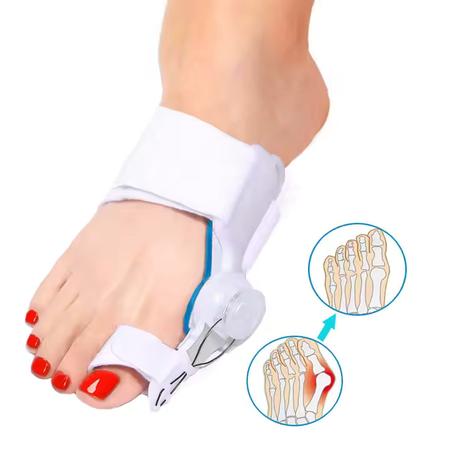 Attelle séparateur d'orteils, orthèse pour hallux valgus, support réglable, correcteur de gros orteil, correcteur d'oignon