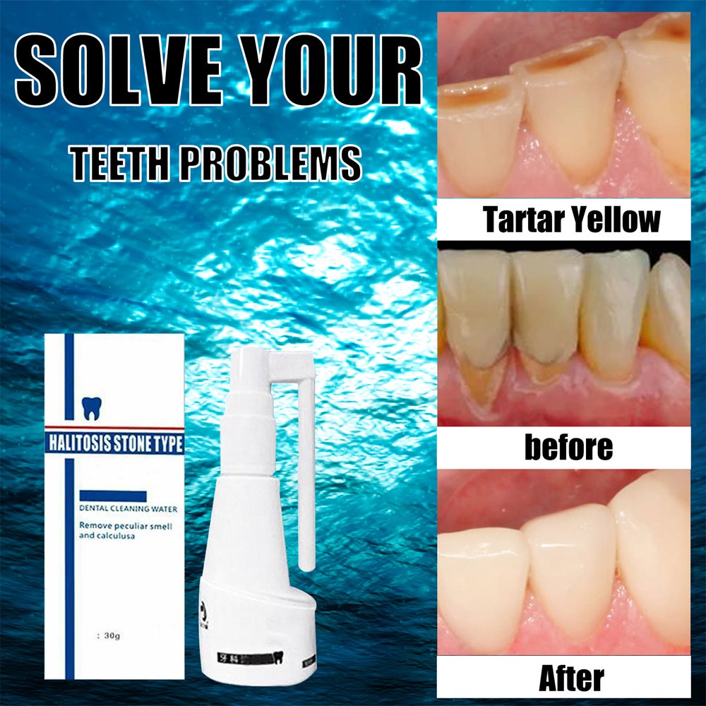 Teeth Whitening Spray