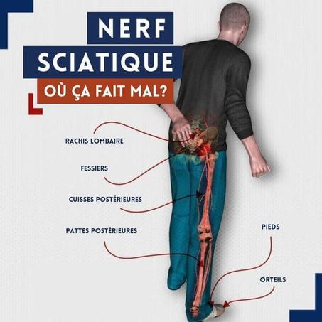 Spray pour douleurs et chocs dans la région lombaire et la jambe-et