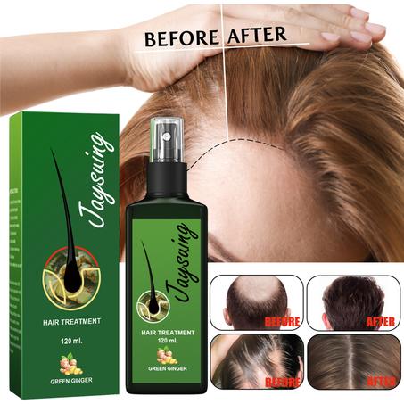 Ginger Hair Growth Nourishing Spray 🇸🇦