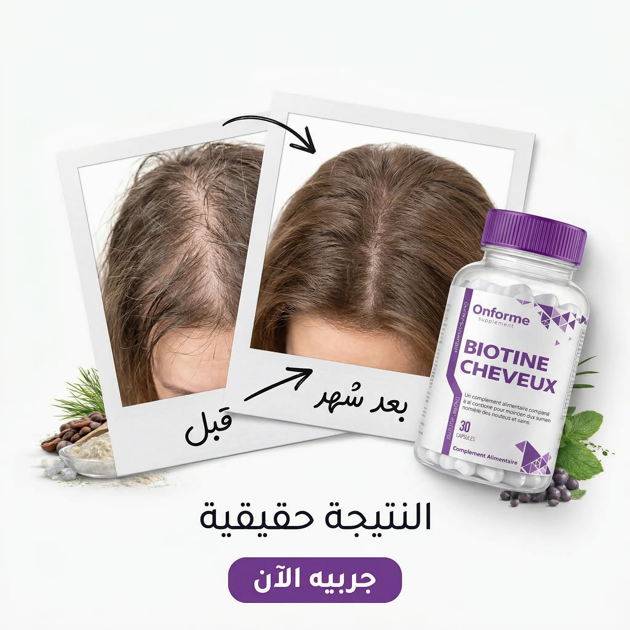 بيوتين للشعر – 30 كبسولة