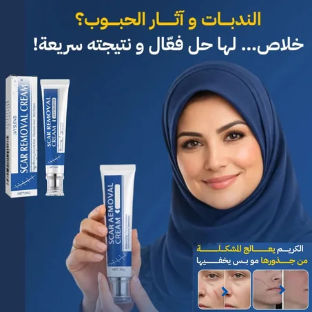 مرهم ازالة الزوائد الجلدية