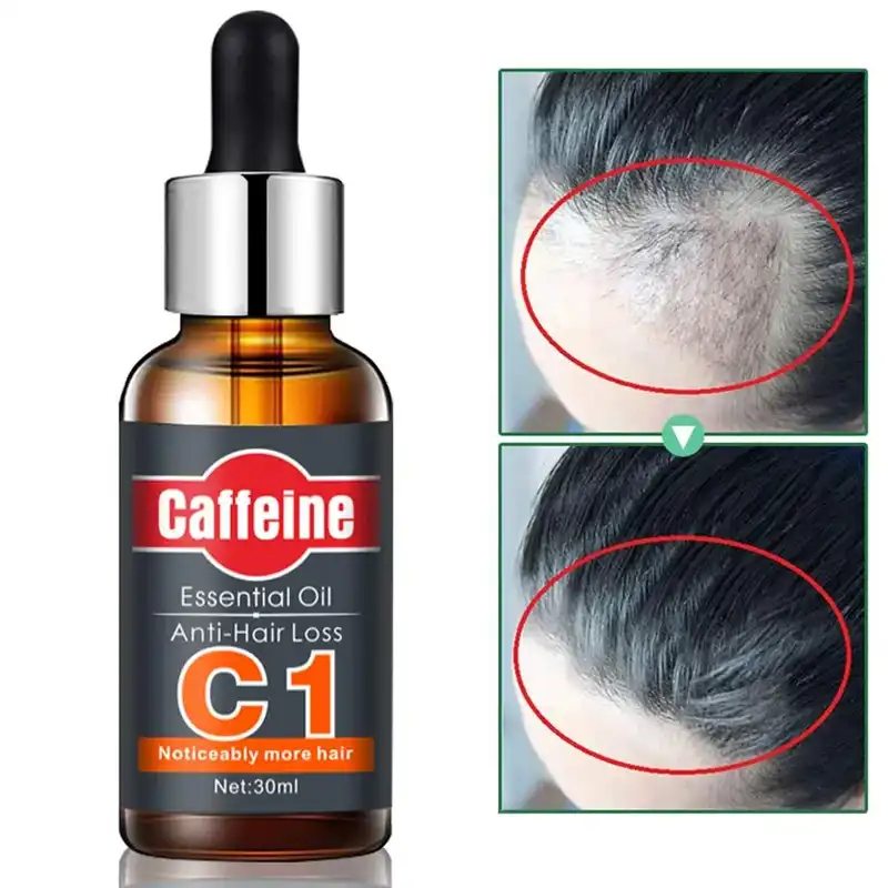 زيت مضاد لتساقط الشعر مع الكافيين