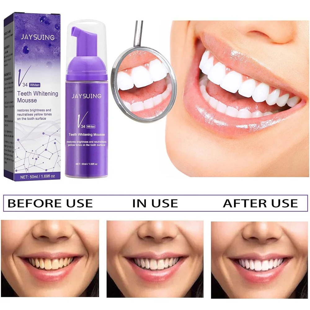 عرض 2 Whitening Foam Toothpaste