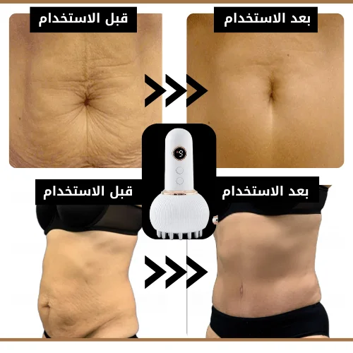 ودّعي سيلوليت البطن وارجعي تشوفين نفسك بثقة وجمال