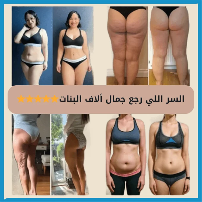تخلّصي من مظهر قشرة البرتقال ( مظهر السيلوليت ) وارجعي ثقتك بنفسك في أسبوعين بس 💃