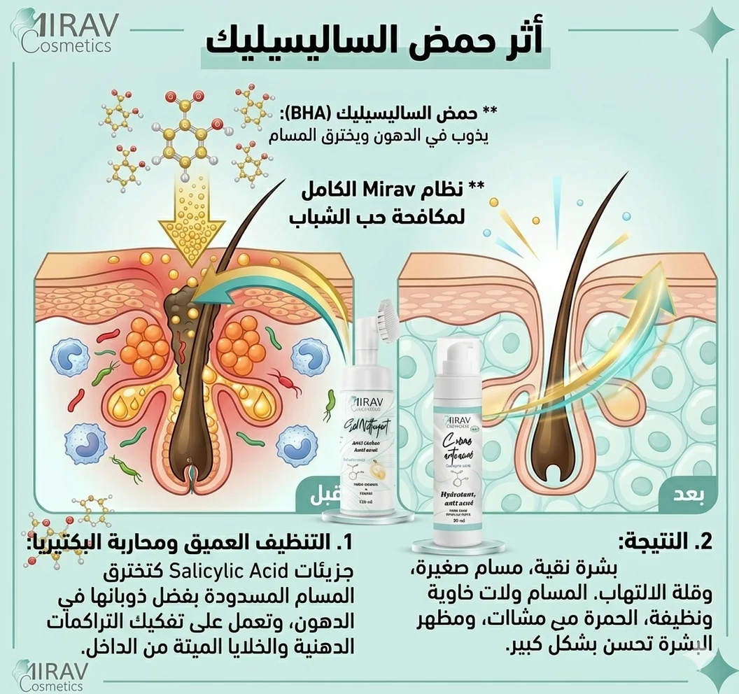 باقة العلاج الشامل لمحاربة حب الشباب والشوائب – Mirav Cosmetics