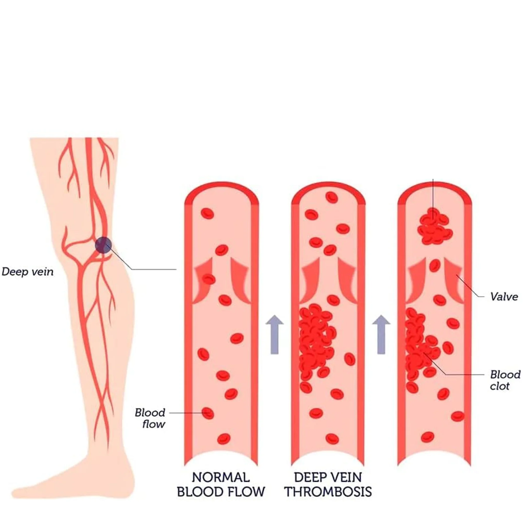 مشد ضاغط  بالحرارة للركبة و الساق