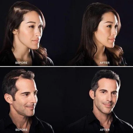 توبيك الياف الكيراتين تخفي الصلع وتملأ الشعر