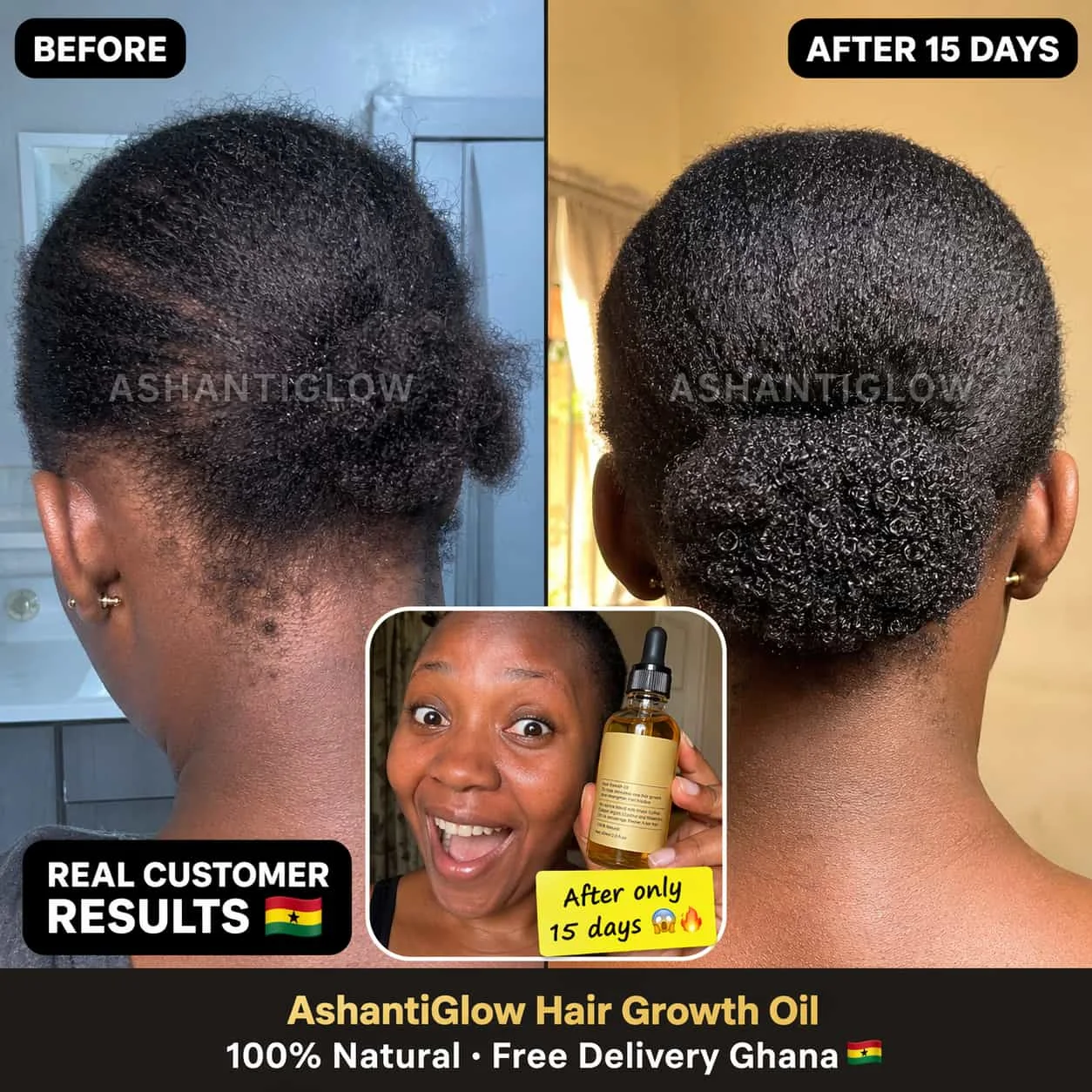AshantiGlow Hair Growth Oil