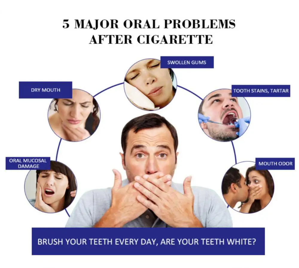 Le dentifrice élimine les taches de fumée, les taches de thé, les taches de café