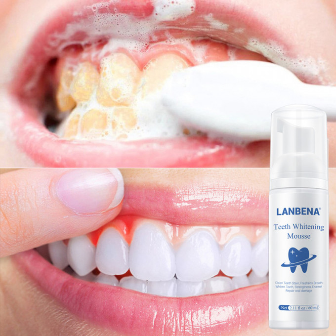 Le blanchisseur de dents efficace le plus populaire et original, LANBENA