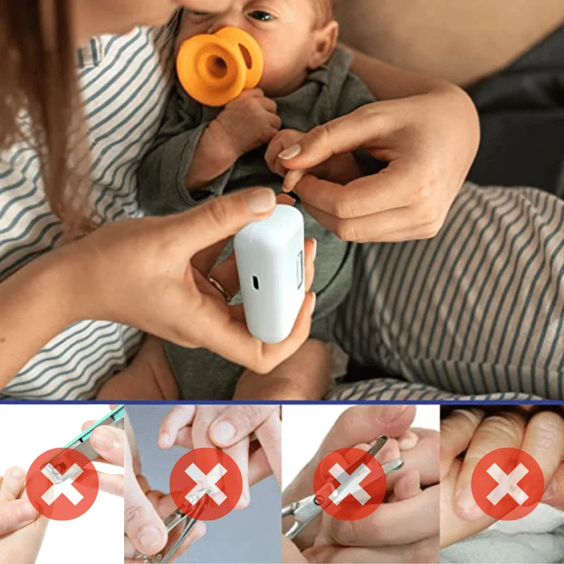 قصافة الاضافر الذكية من XIAOMI