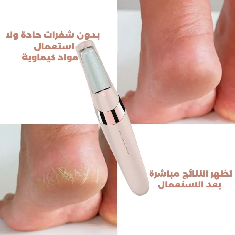مقشر القدم الكهربائي