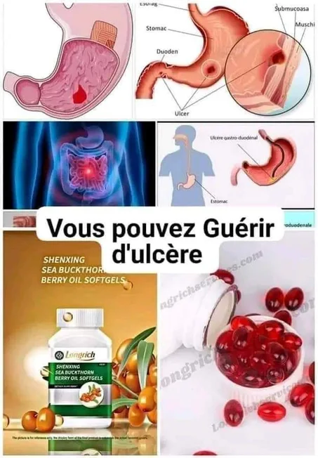 BERRY OIL DE LONGRICH