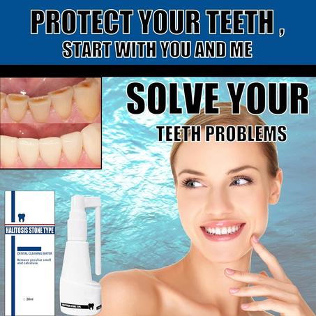 Vaporisateur oral puissant dissolvant le tartre ShinTeet