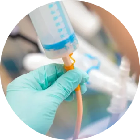 Alimentaion par sonde