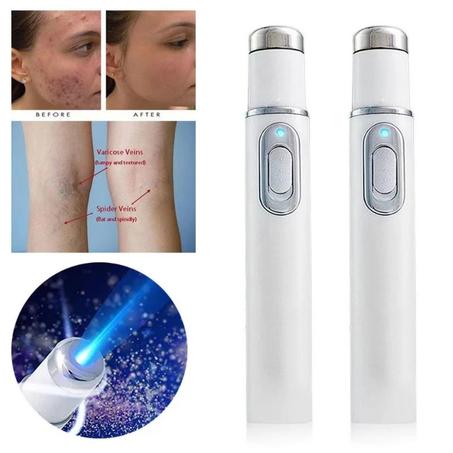 Laser pen For Skin Care