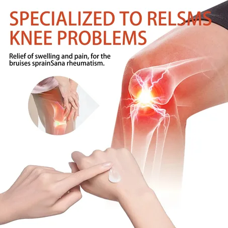 Baume Thérapeutique aux Bois de Cerf – Soulagez vos douleurs naturellement !