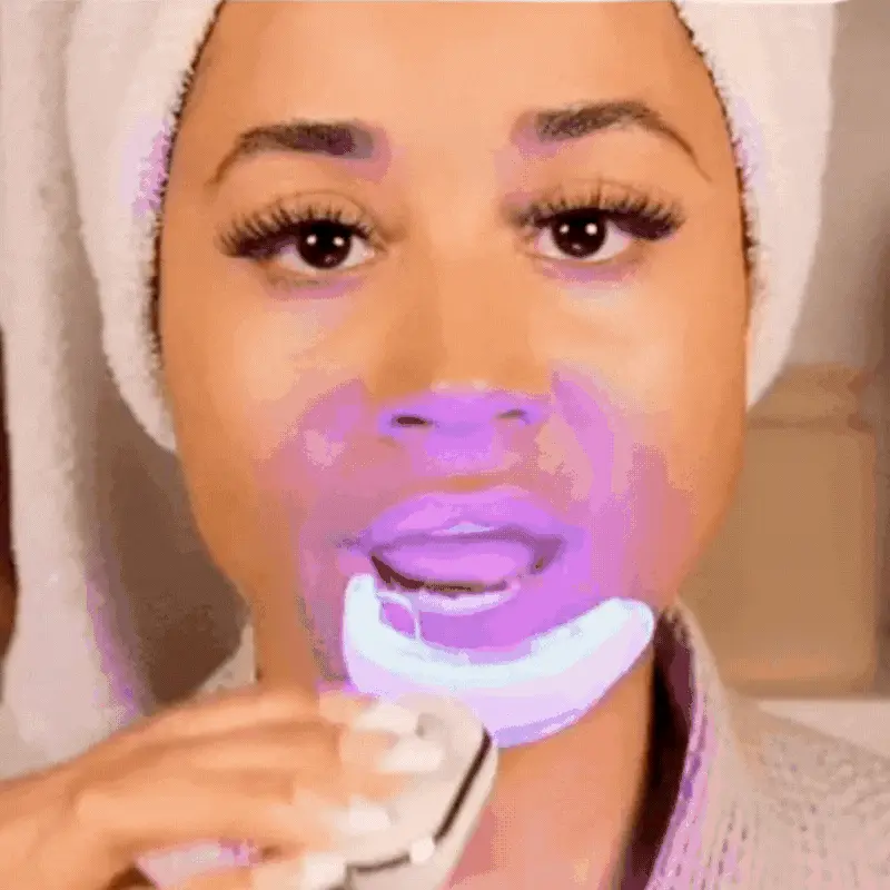 Kit De Blanchiment Des Dents