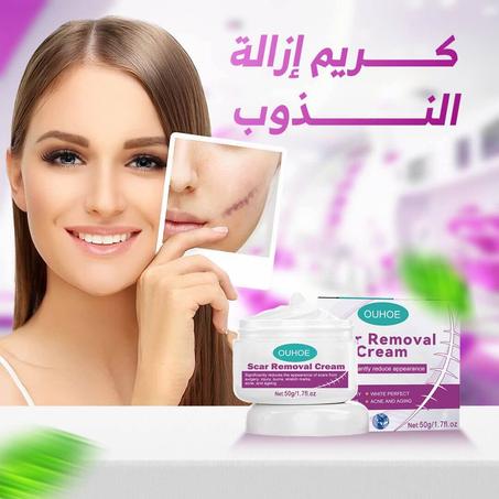 كريم إزالة الندبات Magic scar removal cream