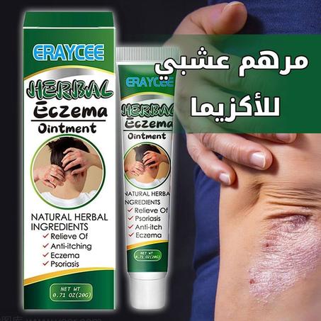 مرهم عشبي للأكزيما Herbal Ointment For Eczema