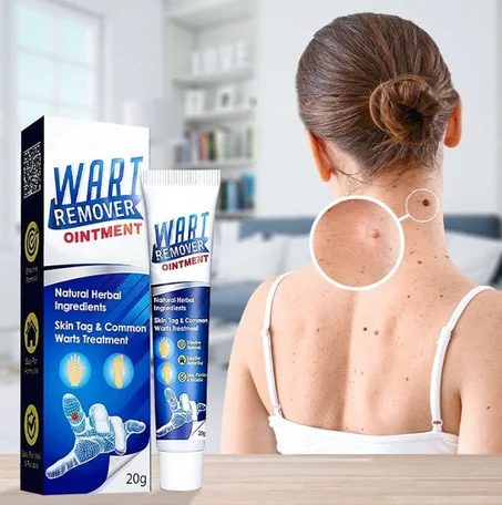 كريم Avyaan لإزالة الثآليل والبقع – حل سريع وآمن لإزالة الثآليل من الجسم والوجه بدون ندبات