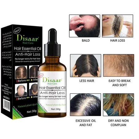 زيت مضاد لتساقط الشعر