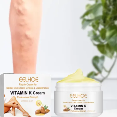 كريم فيتامين K لعلاج الدوالي وتخفيف التورّم