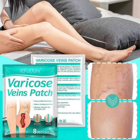 لاصقات علاج الدوالي – راحة فورية وخفة