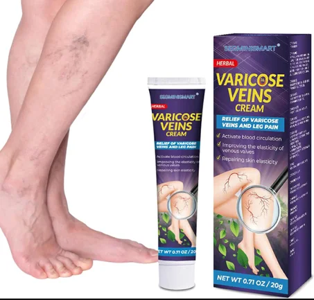 حل عشبي لتقليل بروز العروق وتنشيط الدورة الدموية