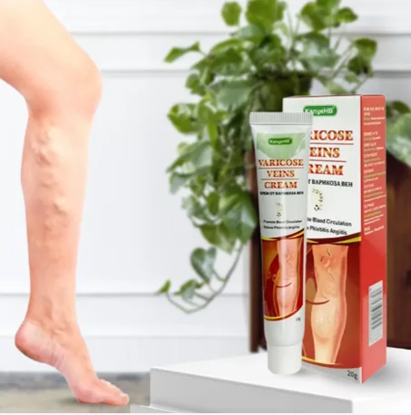 حل عشبي لتقليل بروز العروق وتنشيط الدورة الدموية