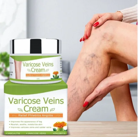 كريم مهدّئ للساقين وداعم للدورة الدموية