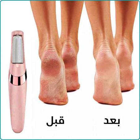 مقشر القدمين الكهربائي