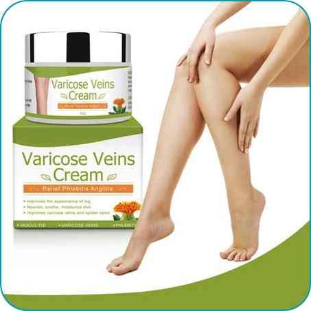 كريم توسع الأوردة-  الدوالي