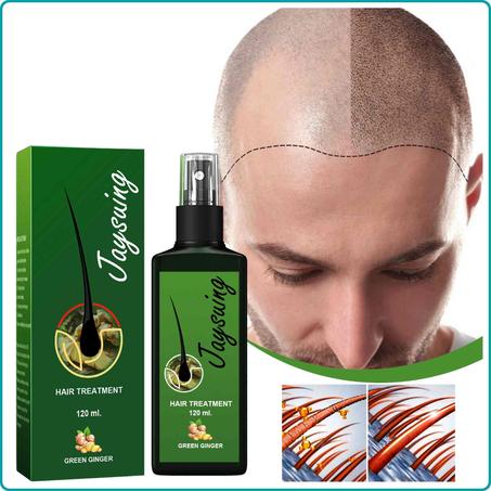 بخاخ جينجر لنمو الشعر