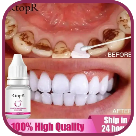 مبيض الأسنان