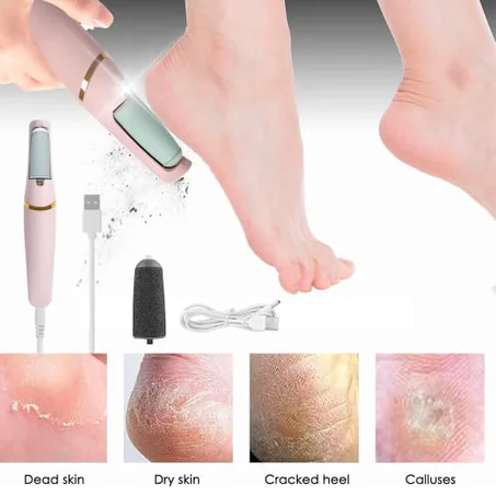 جهاز تقشر و ازالة الجلد الميت (وداعا للإحراج امام الناس)