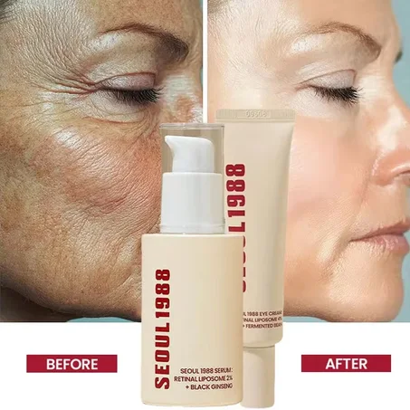SEOUL 1988 Soin anti-rides de rétinal