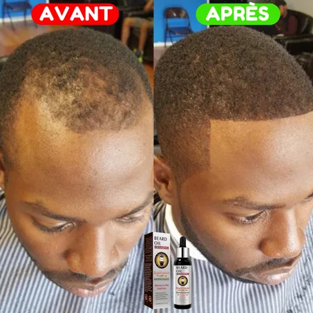 Huile de croissance de barbe et de cheveux