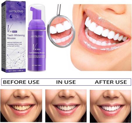 Foam Teeth Whitening مبيض الأسنان