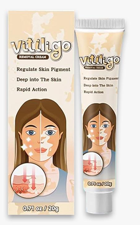 VITILIGO