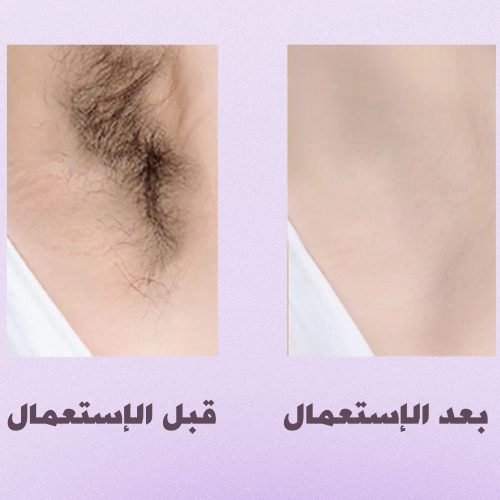 ماكينة حلاقة وتشذيب نسائية 5 في 1